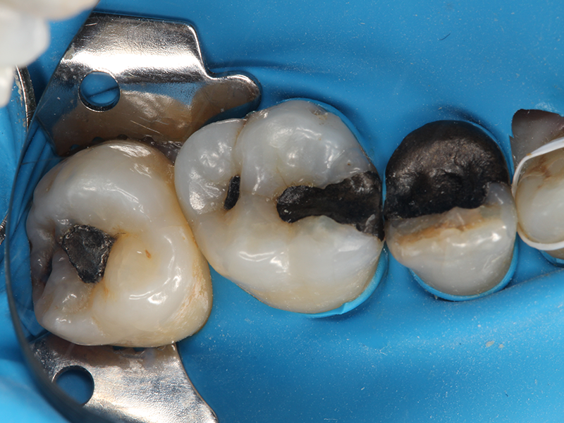 clinicaculto-composites-a