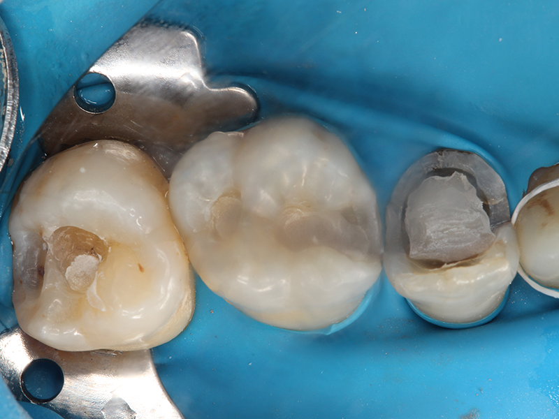 clinicaculto-composites-b