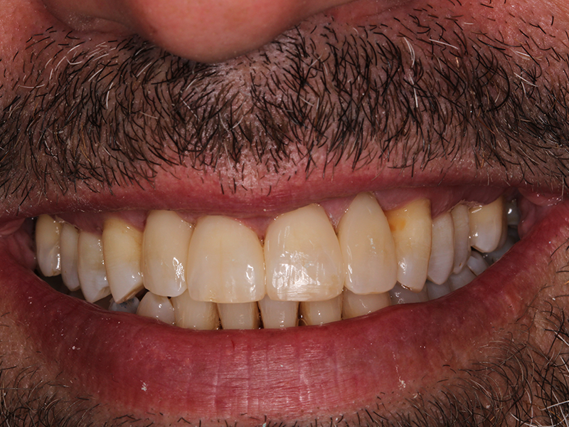 clinicaculto-composites-d