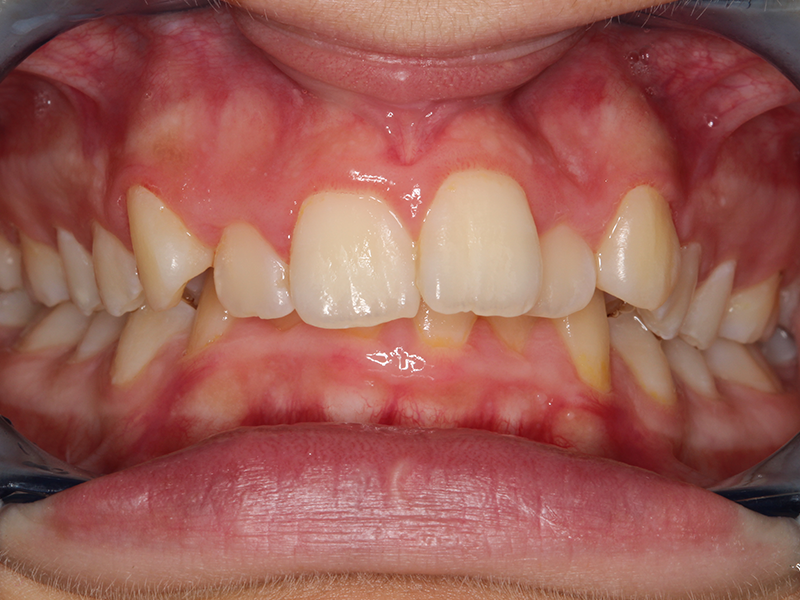 clinicaculto-ortodoncia-c